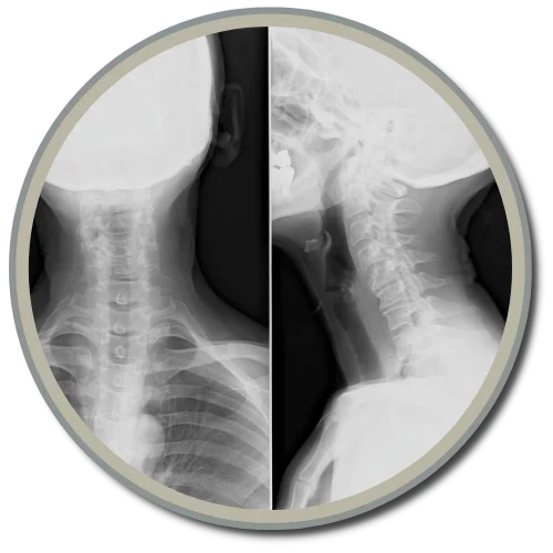 Gonstead X-rays1